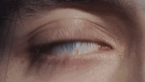 a close up of a person 's eye with a white pupil