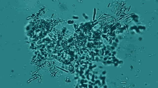 a close up of a cell under a microscope with a blue background .