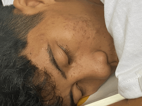 a close up of a person 's face with a white shirt on