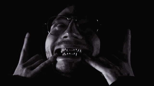 a man with glasses and grills on his teeth is making a face