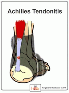 Achillies Tendonitis GIF - Achilles Achilles Tendonitis Achilles Tendon GIFs