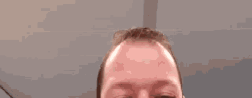 a close up of a man 's forehead with a blue background