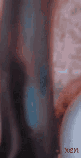 a blurred image of a person with the word xen on the bottom left
