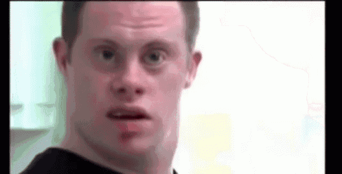 a man with down syndrome is making a funny face in a close up of his face .