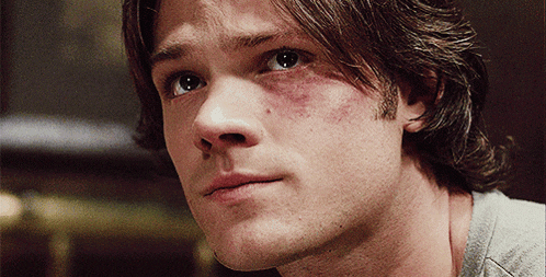 a close up of a man 's face with a bruise on his face