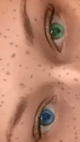 a close up of a person 's eyes with blue and green eyes and freckles .
