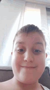 a young boy with a black spot on his eye is smiling for the camera