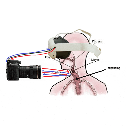 a diagram of a person 's larynx with a camera attached to it