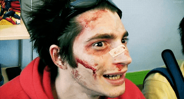 a man with a bandage on his face has a sticker on his nose that says ' g.i.d. '