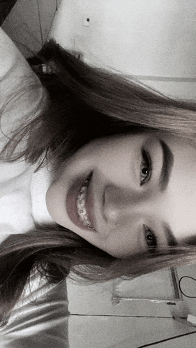 a girl with braces on her teeth is smiling for the camera