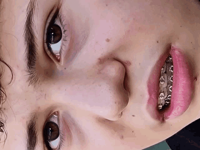 a close up of a person 's face with braces and pink lips