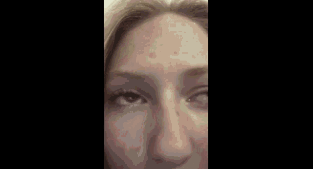 a close up of a woman 's forehead with a few freckles
