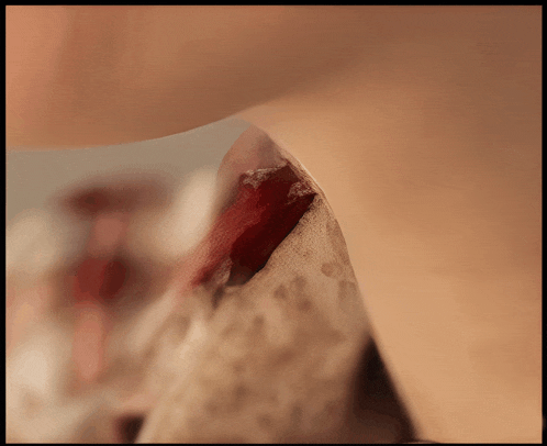 a close up of a person 's neck with a bloody spot on it