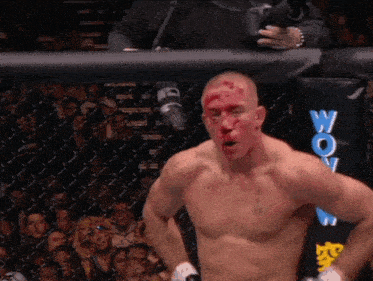 a man with blood on his face stands in front of a fence that says wow