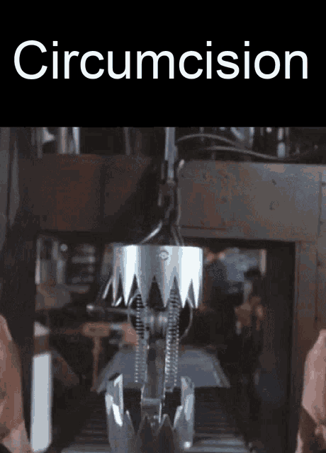 a picture of a machine with the word circumcision on it
