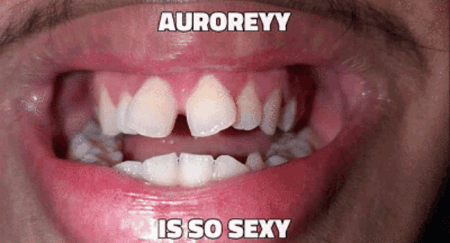 a close up of a person 's mouth with the words auroreyy is so sexy written on it