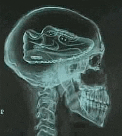 an x-ray of a person 's head with a shoe in the middle of it .