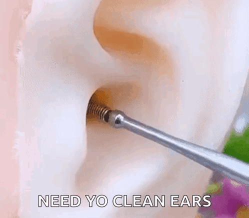 Ear Wax Earwax Removal GIF - Ear Wax Earwax Removal GIFs