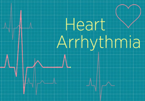 Arrhythmia Cardiac GIF - Arrhythmia Cardiac Beat GIFs