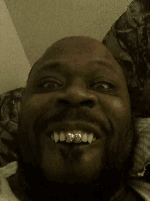 a close up of a man 's face with his teeth visible