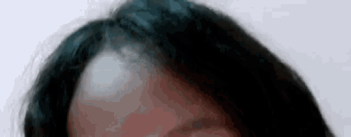 a close up of a woman 's forehead with a white spot on it .