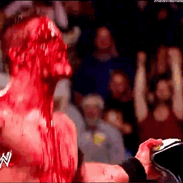a wrestler with blood coming out of his head holds a microphone
