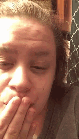 a woman with a bandage on her forehead covering her mouth