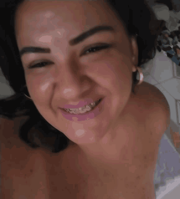 a woman with braces on her teeth smiles for a picture
