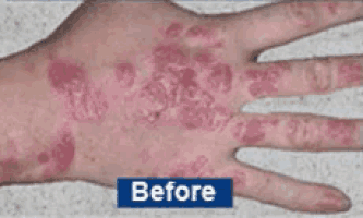 a close up of a person 's hand with the words `` after '' written on it .