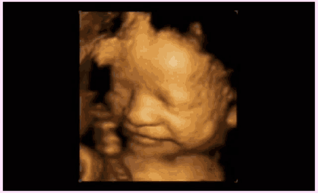 an ultrasound of a baby 's face with a black background