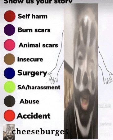 a picture of a person 's face with a list of different types of scars and surgery .