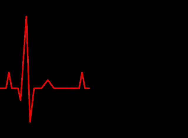 a red line on a black background that looks like an ecg