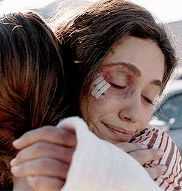 a woman with a bandage on her face hugs another woman