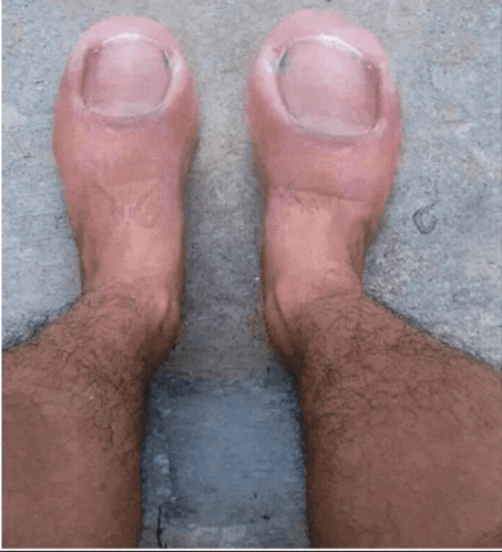 a pair of feet with very long nails and hair