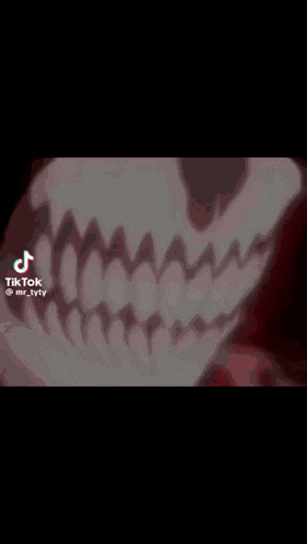 a close up of a person 's teeth with a tiktok logo in the corner .