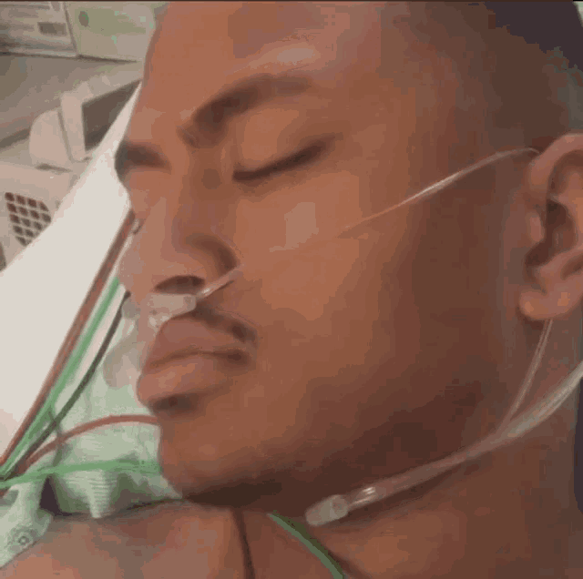 a man with an oxygen mask on his face