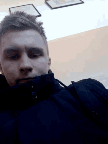 a man with a black eye and a black jacket looks at the camera