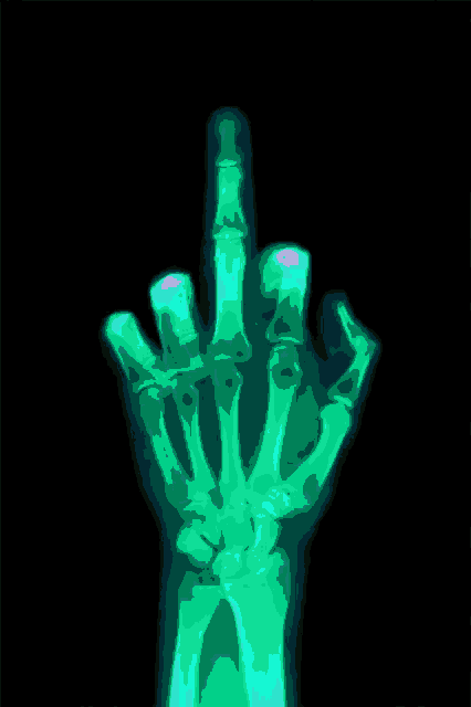 an x-ray of a hand shows the middle finger