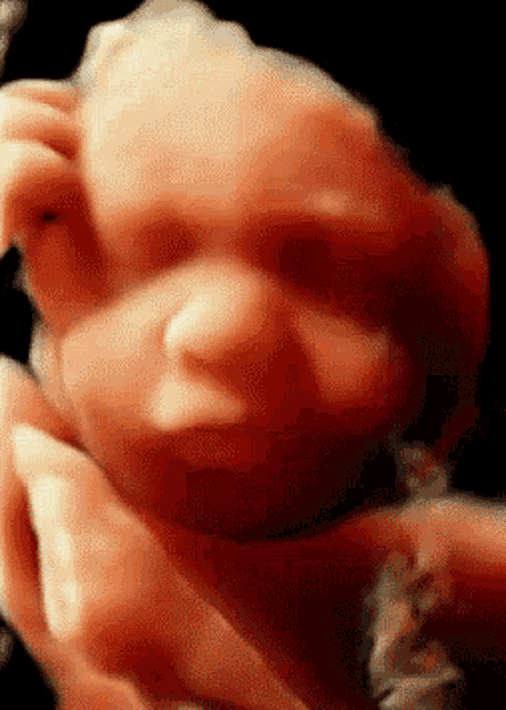 Sonography GIF - Sonography GIFs