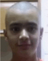 a close up of a person 's face with a bald head .