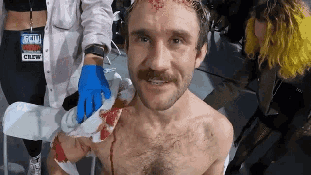 a man with blood on his face has a grill wrestler crew tag on his shirt