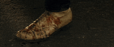 a man wearing a watch on his wrist has blood on his sleeves