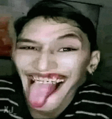a man with braces on his teeth is sticking out his tongue .