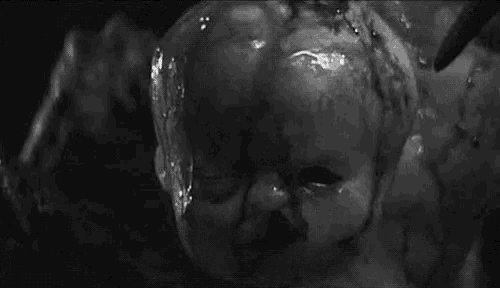 a black and white photo of a baby with blood coming out of its mouth .