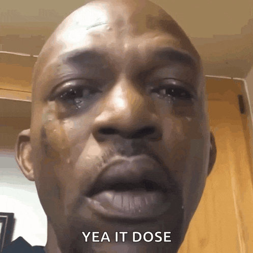 a close up of a man 's face with a tear coming out of his eye and the words yea it dose below him