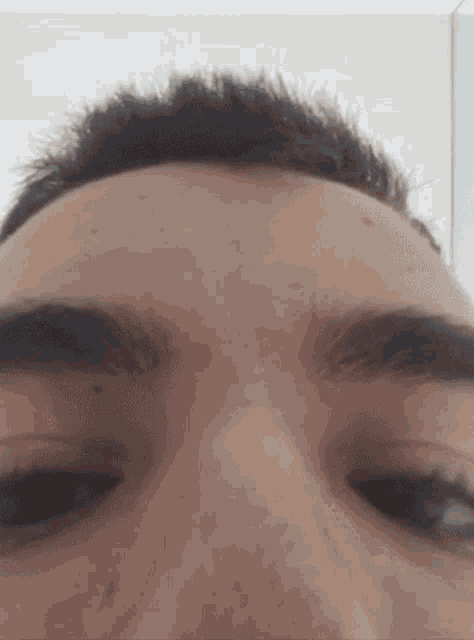 a close up of a person 's forehead with a few hairs on it