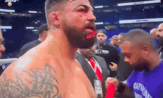 a man with a beard is standing in a boxing ring with a bloody face .