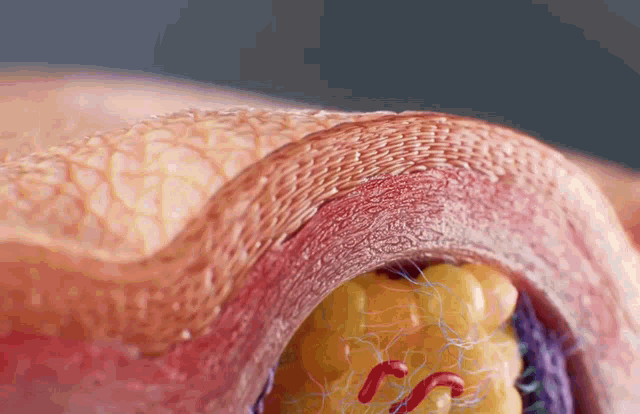 a close up of a blood vessel with a few worms coming out of it