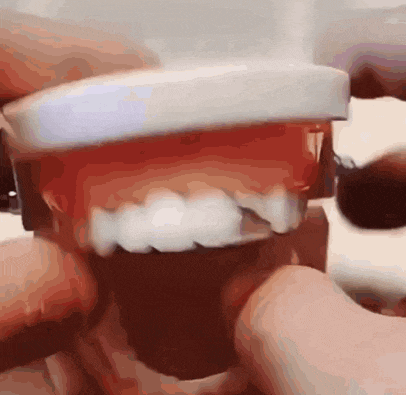 a person is holding a model of a person 's teeth with white teeth .