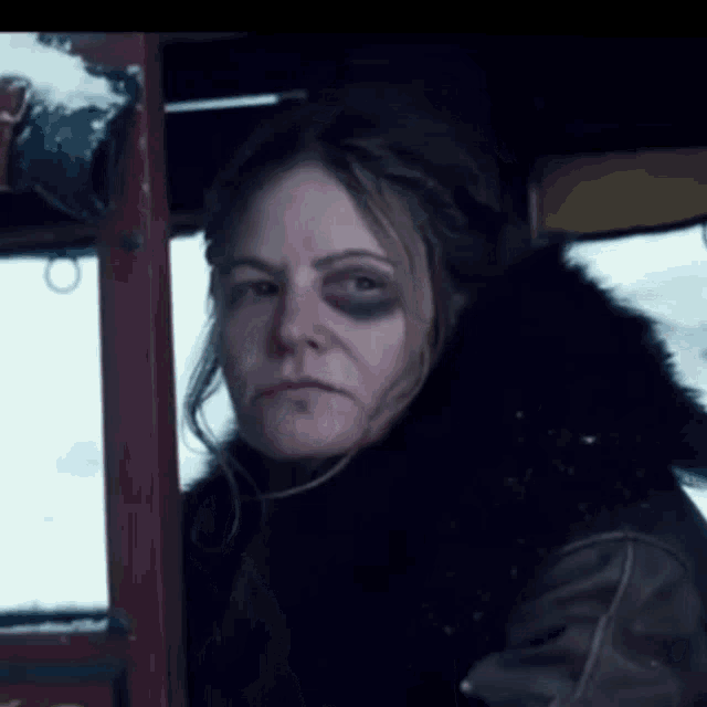 a woman with a black eye and a fur coat